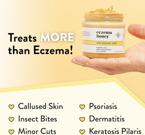 Eczema Cream